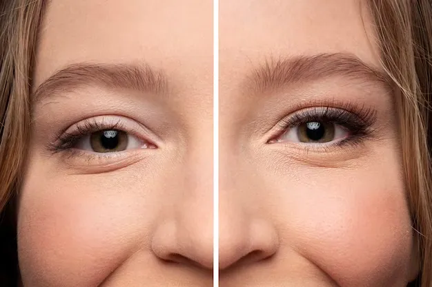 botox port st lucie