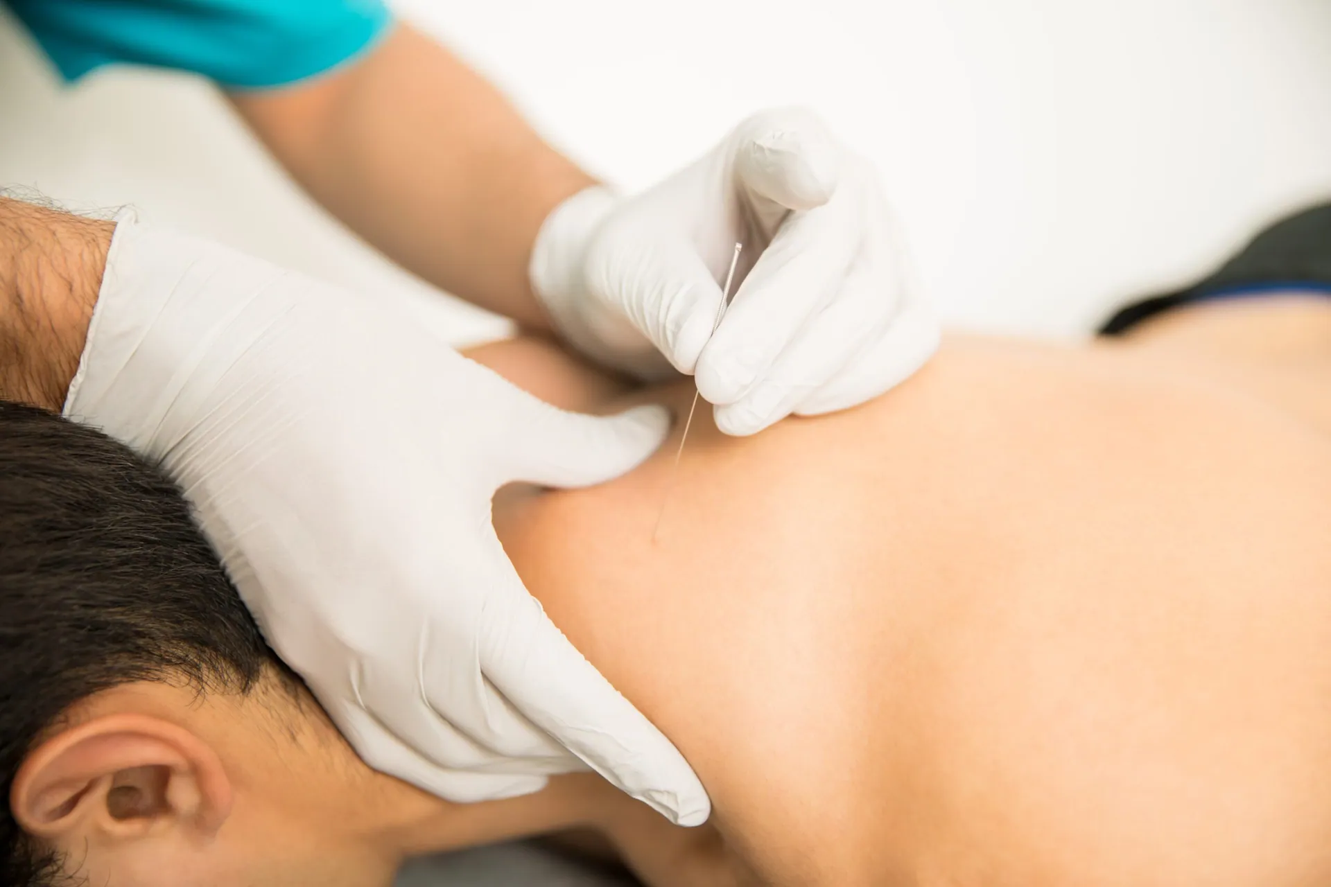Licensed acupuncture therapists in Port St Lucie