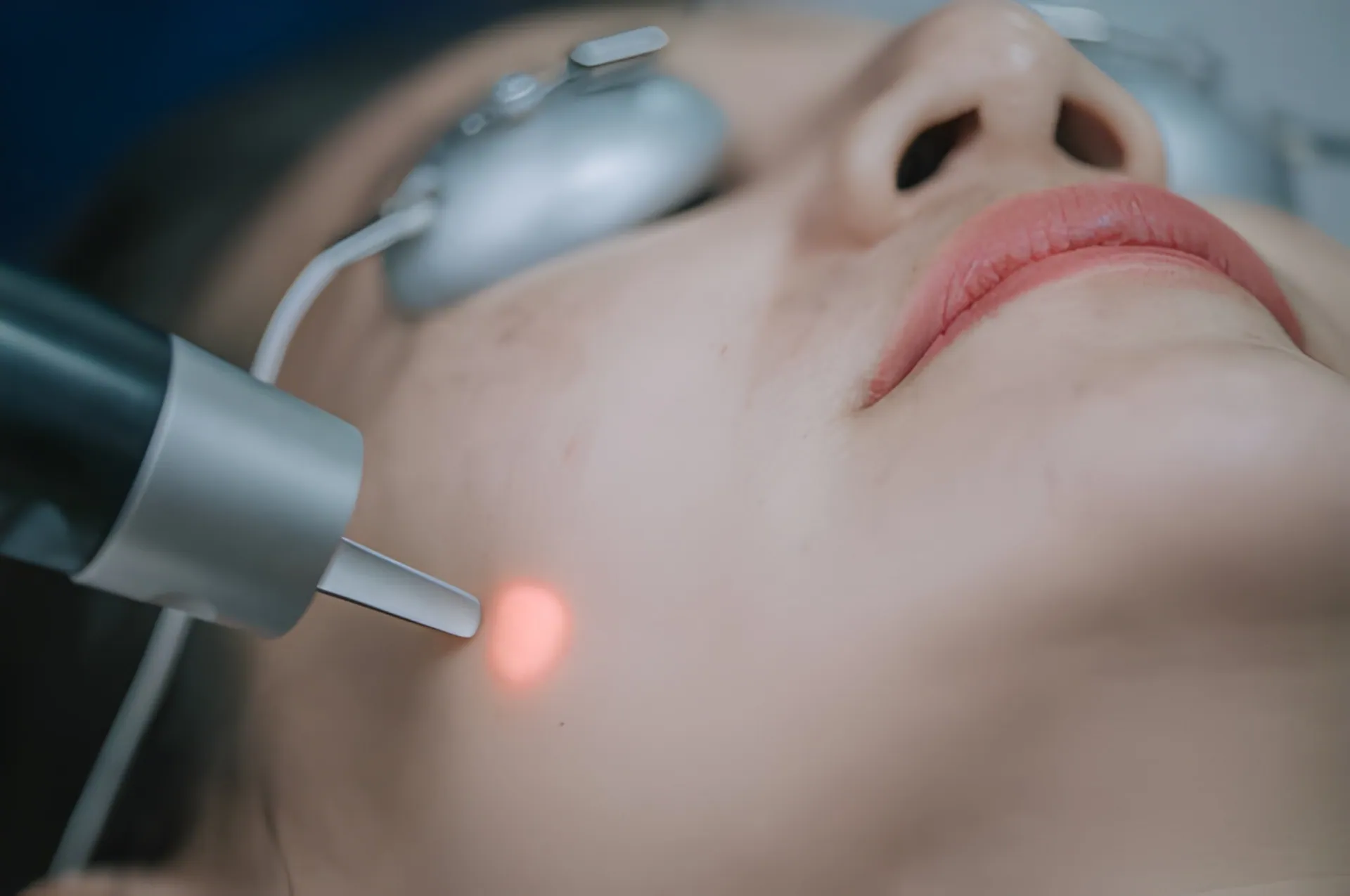 Laser hair removal Port St Lucie patient receiving advanced skin treatment at PSL Health Center