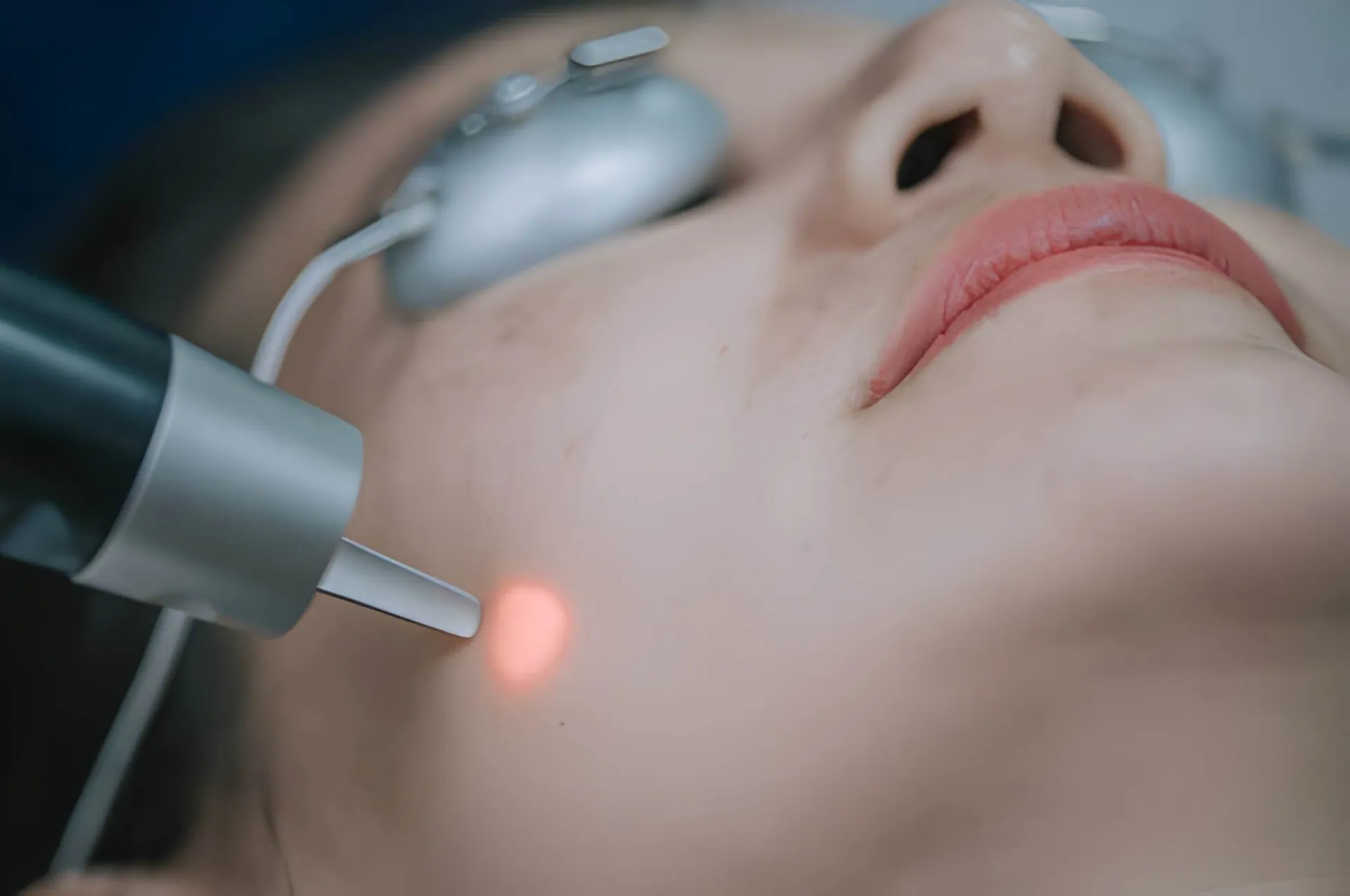 Treasure Coast Laser performing facial rejuvenation with red-light laser device and protective eyewear.